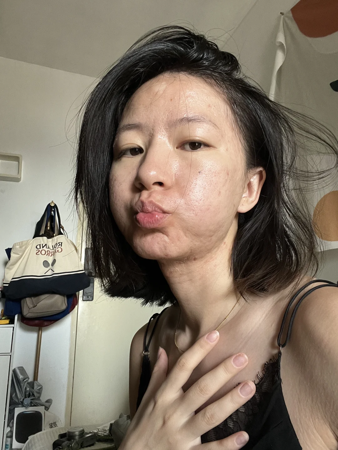 25 years of base makeup with acne scars and blemished skin | 12 photos of annual base makeup after viewing