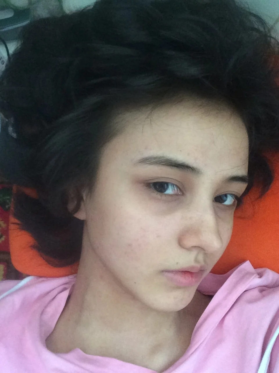 Slide left to see the defective skin, and use concealer for the first time