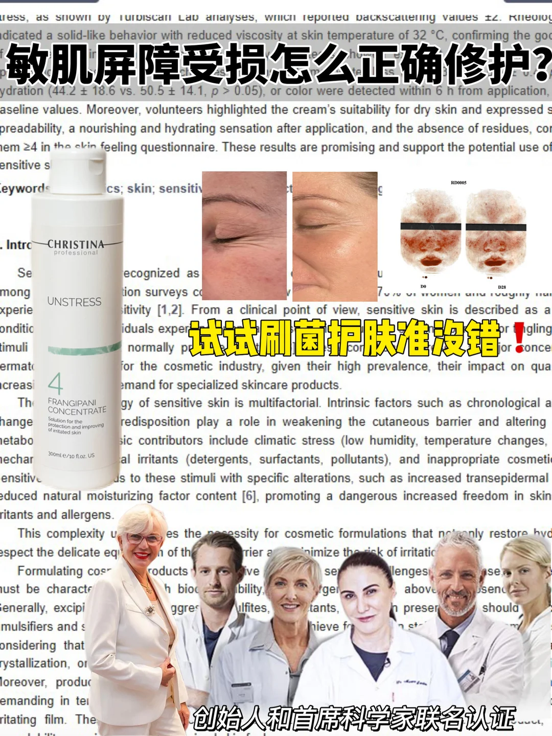 Popular Science Brushing Skin Care: Root Solution of Sensitive Muscle anti-aging