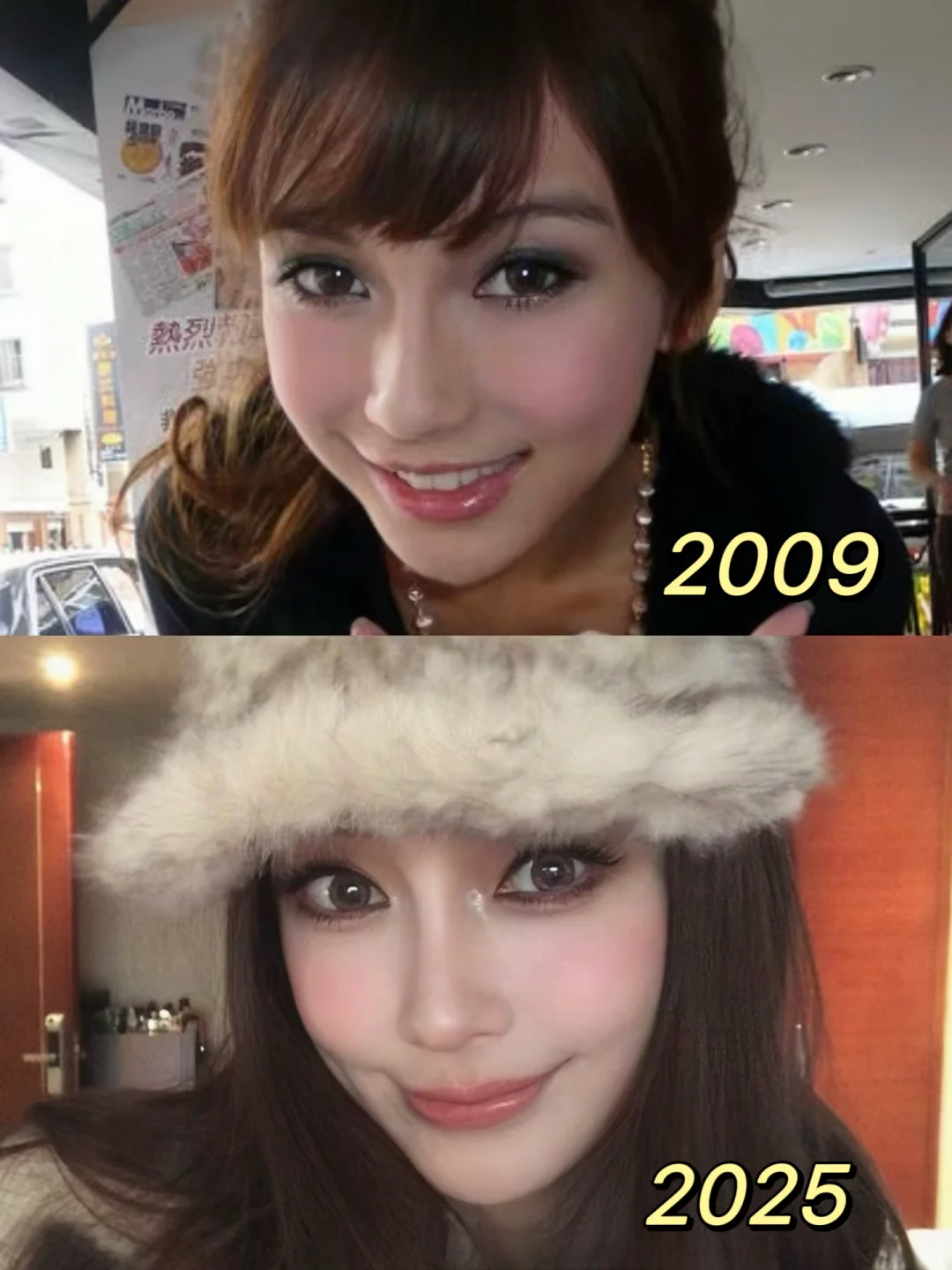 Does the dreamy young model's nose sister resist so much because of her bone appearance??