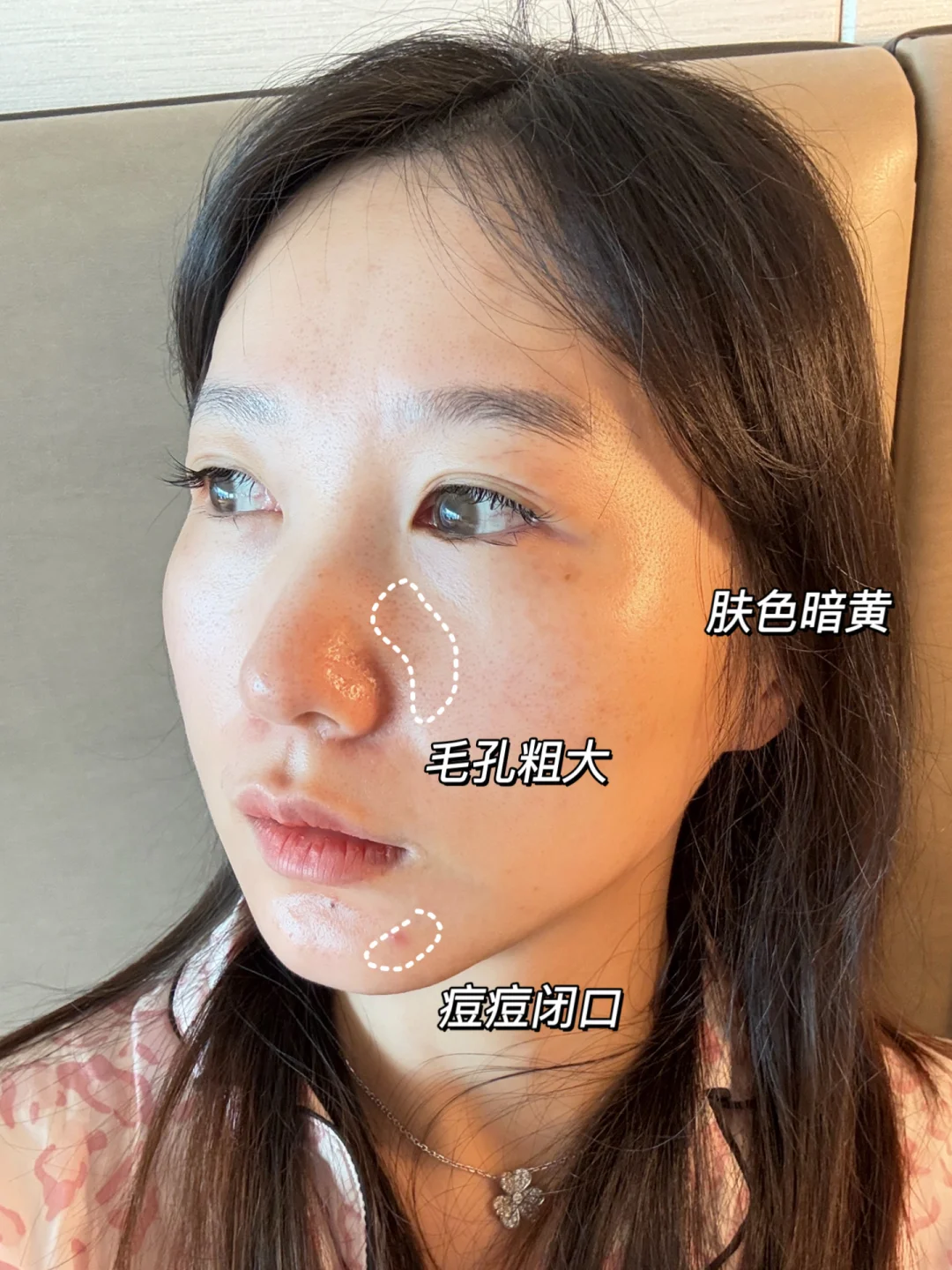 Autumn and winter counterattack, sensitive skin can also improve dark yellow skin!