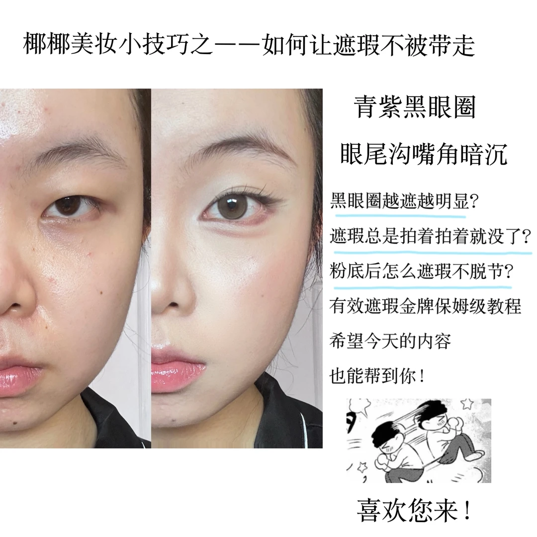 Teacher, our child's dark circles always become more and more obvious when we cover them up. What should we do