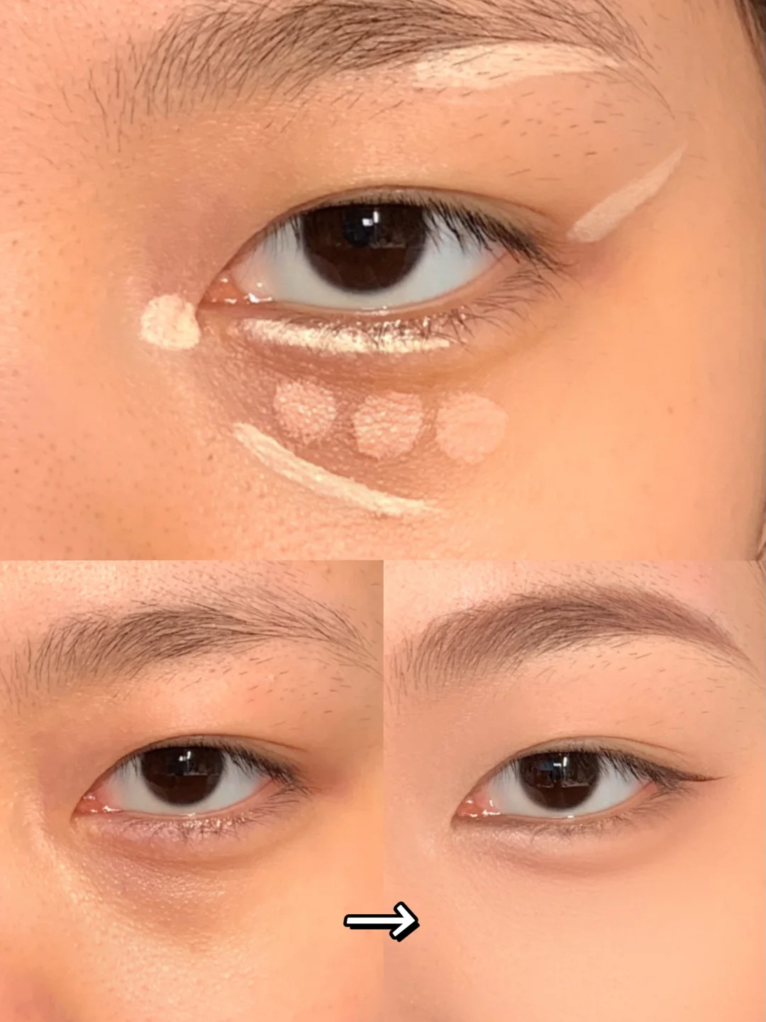 The tear troughs disappear in place! Severe dark circles must learn structure concealer!