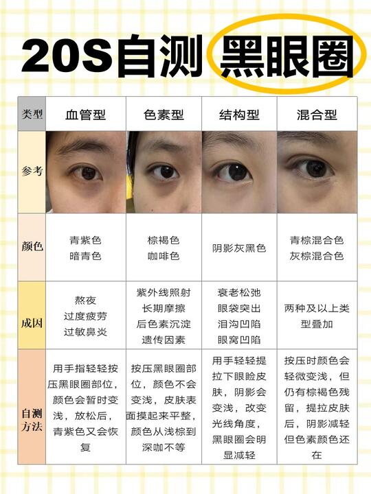 I suggest everyone self check for dark circles under their eyes